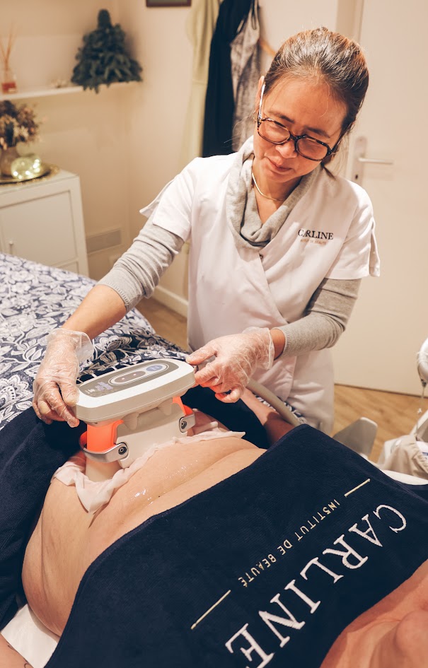 Cryolipolyse élimination graisse Paris
