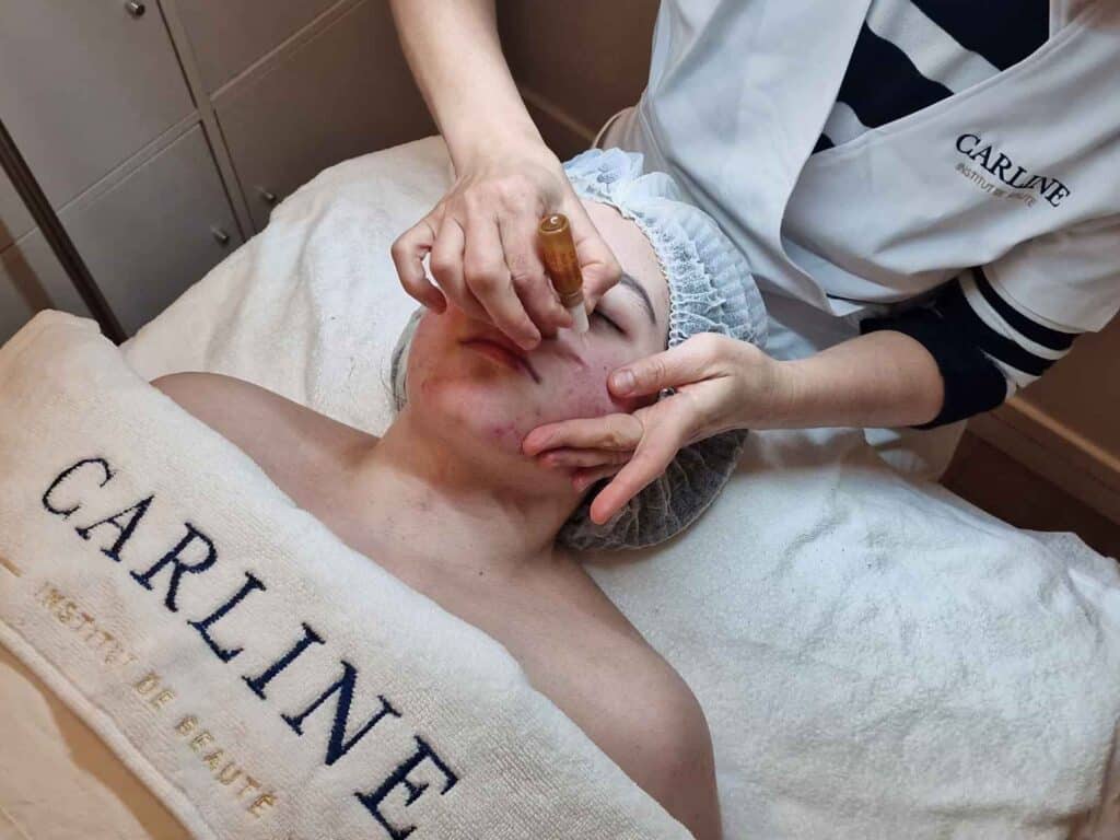 soins Visage pour les peaux à imperfections - Docteur Janka Paris 15