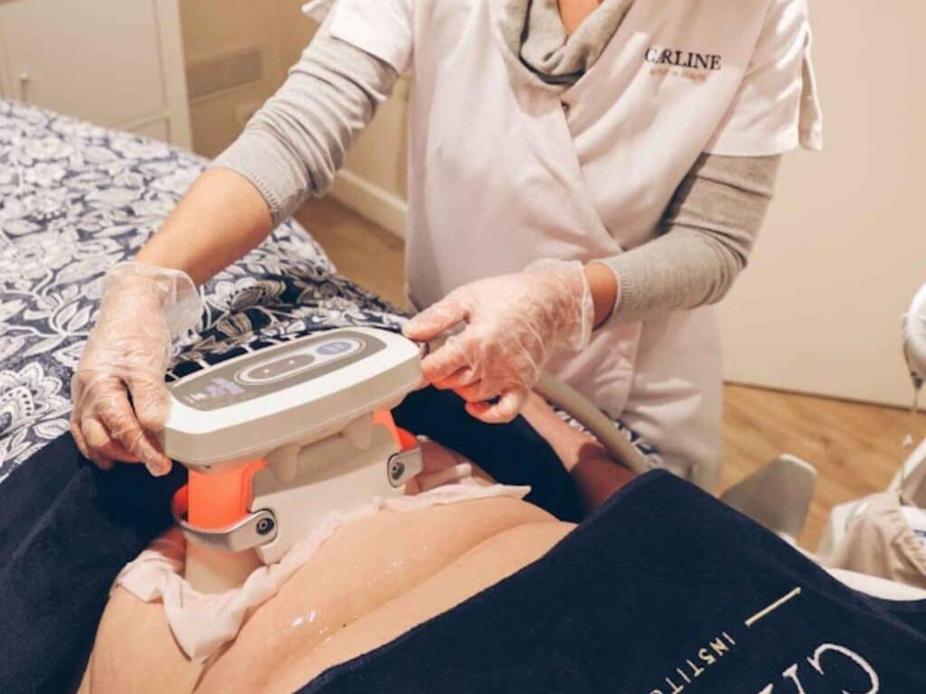 Cryolipolyse pour cibler les amas graisseux à Paris 15